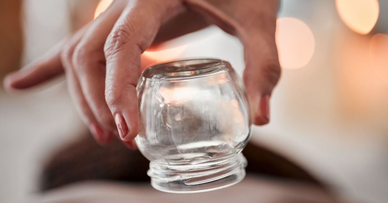 Cupping is a Traditional Chinese Medicine practice. Cupping is a Traditional Chinese Medicine practice.